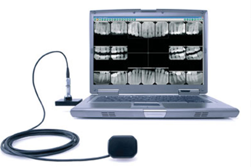 Digital X-Rays in 